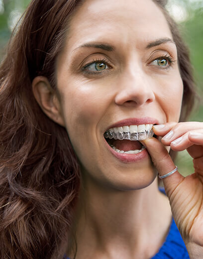 Invisalign® treatment for adults