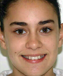 Face Before Face Before